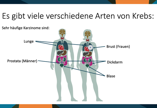 Abbildung von Karzinomen in Lunge, Prostata, Brust, Dickdarm und Blase