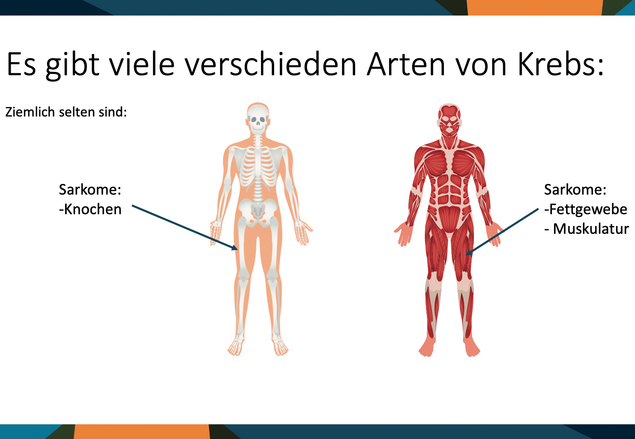Abbildung von Sarkomen in Knochen und Fettgewebe und Muskulatur
