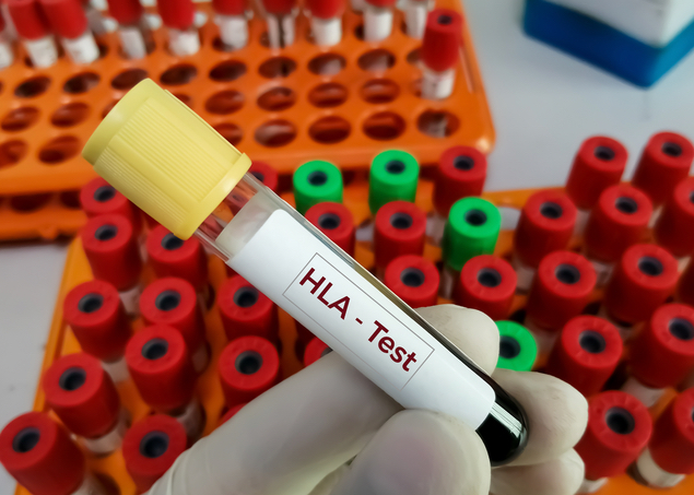 HLA Human leucocyte antigen