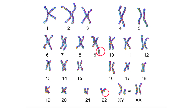 Bild, das zeigt, dass sowohl das 9. und das 22. Chromoson verändert sind.